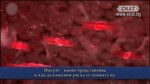 Д-р Анъл Хюсменов, невролог в МЦ "Лозенец"  в студиото на телевизия СКАТ